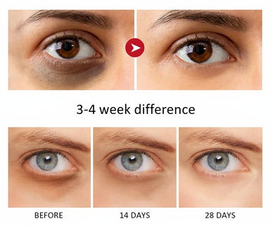 Revitalize Your Eyes for a Youthful Glow